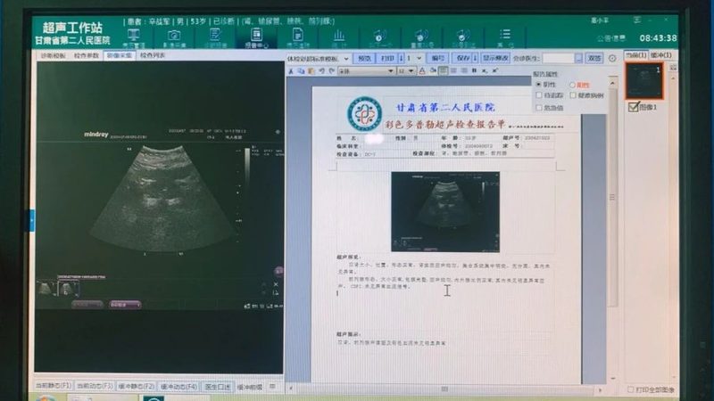 厂矿工人职业体检，关注这些关键点